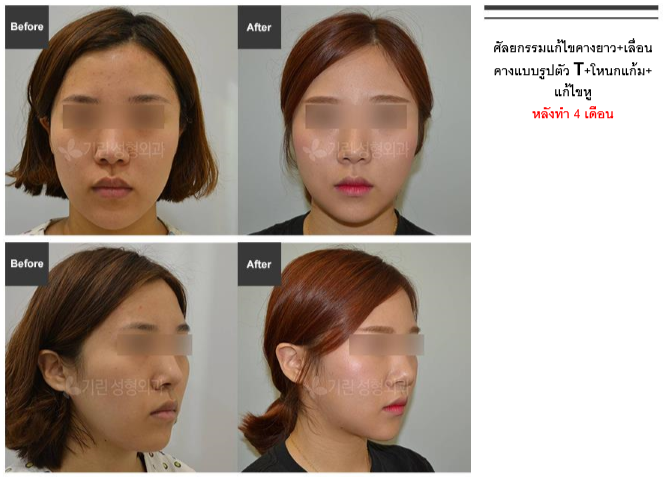 โรงพยาบาลศัลยกรรมกิริน